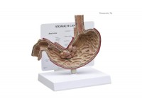 model prawej nerki i nadnercza - 1019549 3b scientific modele anatomiczne 9